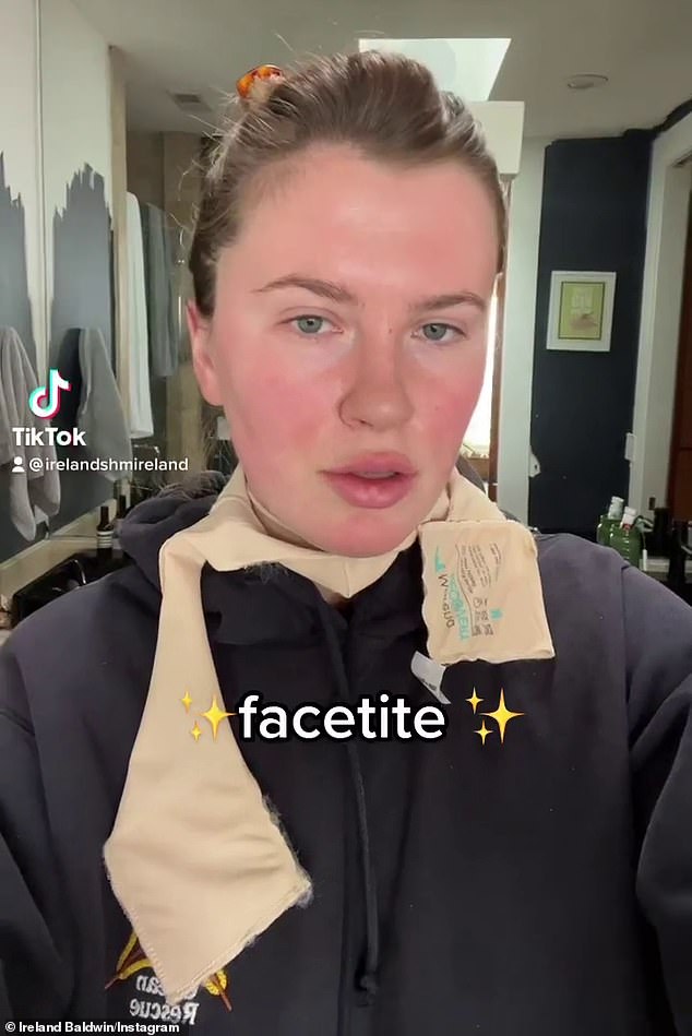 Honest: Ireland Baldwin talks about why she's undergoing FaceTite, a minimally invasive cosmetic procedure comparable to a surgical facelift, this month